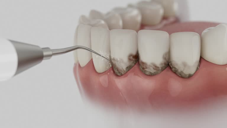 Reliable Teeth Cleaning And Checkup contractor in ﻿Harrison County County, MO by Dentist Open Now
